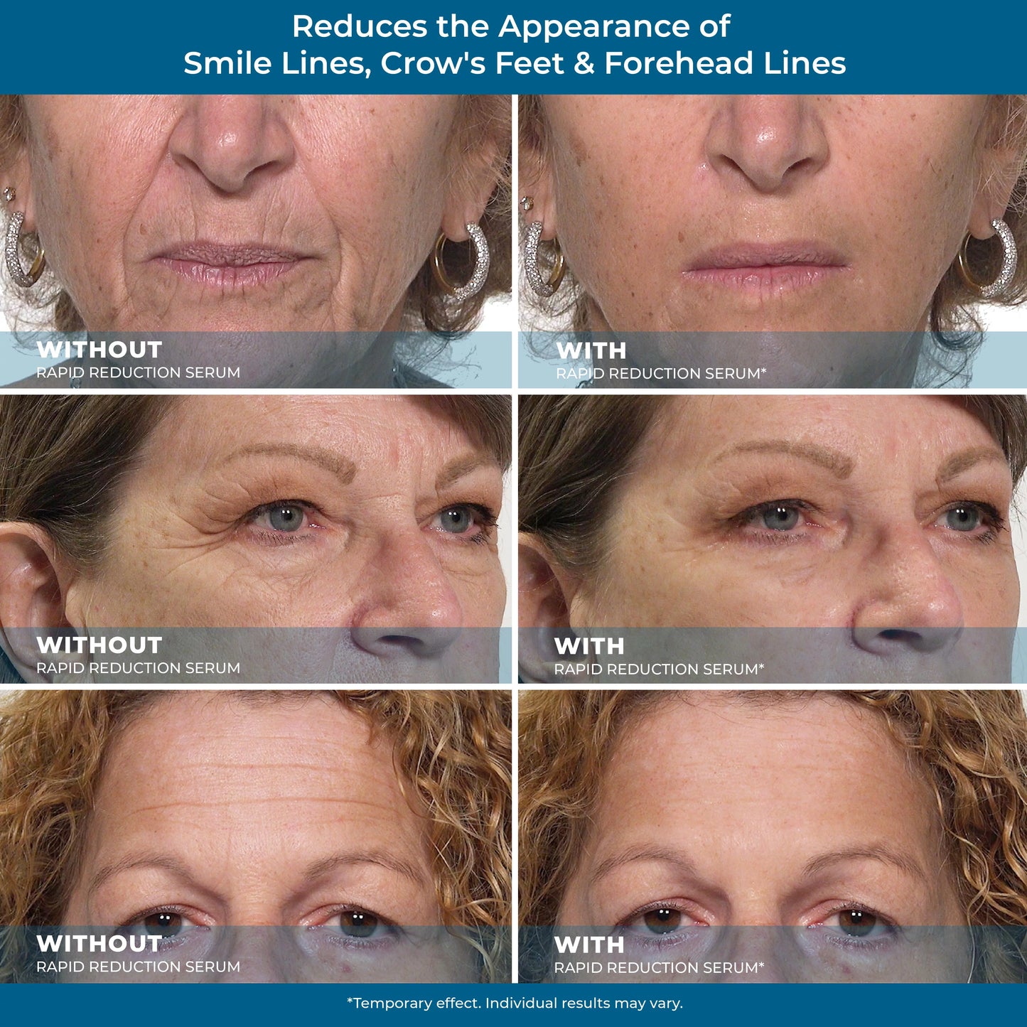 Rapid Reduction Eye Serum for Under-Eye Bags, Wrinkles & Dark Circles N8205